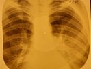 Bob Dylan - I Want You X-RAY OF USSR X-RAY BONE RECORDING