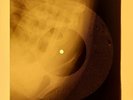 Frank Sinatra - Strangers In The Night X-RAY OF THE USSR X-RAY BONE RECORDING