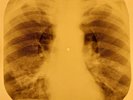 John Lennon - Woman  X-RAY OF THE USSR X-RAY BONE RECORDS