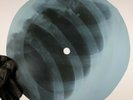 WHO SO SAD ABOUT US X-Ray USSR Record Roentgen Ribs Bones Music Vinyl