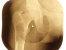 Jefferson Airplane - White Rabbit X-RAY OF THE USSR X-RAY BONES RECORDS