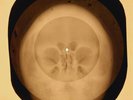 Elvis Presley - In The Ghetto X-RAY OF THE USSR X-RAY BONES RECORDING SKULL