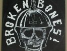 BROKEN BONES - i o u nothing , MLP 1984 D