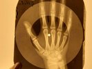 Beatles - Matchbox X-RAY HAND OF THE USSR X-RAY BONES RECORDING