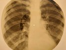 Creedence Clearwater Revival - Proud Mary X-RAY OF USSR X-RAY BONE RECORD