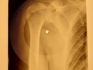 Elvis Presley - That's All Right Mama X-RAY OF USSR X-RAY BONES RECORD