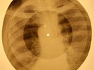 Bobby Vee - Devil Or Angel X-RAY OF THE USSR X-RAY BONES RECORDING