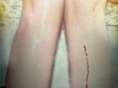 Los Campesinos  - Romance Is Boring (Remastered Vinyl Gold Gatefold)