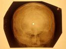 Velvet Underground - That's The Story Of My Life X-RAY OF USSR X-RAY BONE RECORD