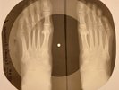 Roy Orbison - Running Scared X-RAY FOOT BONES RECORDS USSR 9