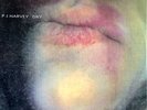 PJ Harvey. Dry. Numbered Copy Of Limited First Run Of 5000. + Demonstration LP.