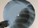 PATSY CLINE SHE'S GOT YOU X-Ray USSR Record Roentgen Bones Ribs Music Vinyl