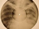 Bob Marley - Is This Love  X-RAY BONES RECORDS USSR 176