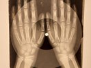 Johnny Cash - Thanks a Lot X-RAY HANDS BONES RECORDS USSR 224
