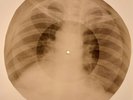 Elvis Presley - Like A Baby X-RAY BONES RECORDS USSR 201