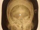 Jimi Hendrix - Purple Haze X-RAY SKULL BONES RECORDS USSR 233