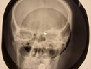 Everly Brothers - Cathy's Clown  X-RAY SKULL USSR BONES RECORDS 360