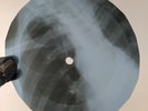 WHO SO SAD ABOUT US X-Ray USSR Record Roentgen Bones Ribs Music Vinyl