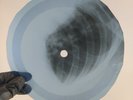 BEATLES NO REPLY X-Ray USSR Record Roentgen Bones Ribs Music Vinyl