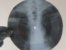 LED ZEPPELIN RAMBLE ON X-Ray USSR Record Roentgen Bones Ribs Music Vinyl