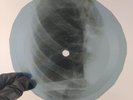 BEATLES ELEANOR RIGBY X-Ray USSR Record Roentgen Bones Ribs Music Vinyl