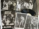 Agnostic Front United Blood Legacy Signed By Roger Lmt Ed  102 Made