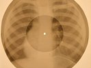 USSR X-RAY ROENTGEN BONES RECORD ORIGINAL OLD RIBS 462