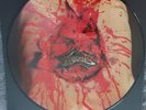 Dismember Picture 1993 Indecent And Obscene Bolthrower Benediction Dissection