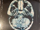 BREAKING BENJAMIN DEAR AGONY Vinyl Record LP SEALED EURO IMPORT