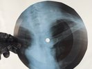 BEATLES YOU WONT SEE ME X-Ray USSR Record Roentgen Bone Ribs Music Vinyl