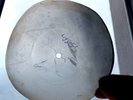 USSR GEORGIAN X-RAY ROENTGEN bones  RECORD  UNIQUE ITEM  AUTHENTIC unknown folk