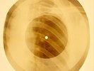 X-RAY USSR ROENTGEN BONES RECORD ORIGINAL OLD RIBS 702