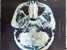 BREAKING BENJAMIN Dear Agony LP And Aurora, Ember 3 Vinyl Bundle