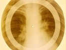 X-RAY USSR ROENTGEN BONES RECORD 78 rpm ORIGINAL OLD RIBS 716