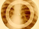 X-RAY USSR ROENTGEN BONES RECORD ORIGINAL OLD RIBS 771