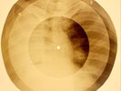X-RAY USSR ROENTGEN BONES RECORD ORIGINAL OLD RIBS 701