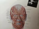 Area ‎– Cursed (Maudits) LP RARE 1 PRINT