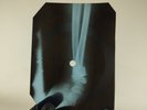 ELVIS HIS LATEST FLAME X-Ray USSR Record Roentgen Bone Ribs Music Vinyl