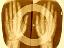 3pcs X-RAY ROENTGEN USSR BONES RECORD 891, 864, 886