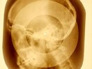 USSR X-RAY SKULL ROENTGEN BONES RECORD ORIGINAL OLD RIBS 928
