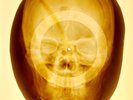 5pcs X-RAY ROENTGEN USSR BONES RECORD 967, 958, 975,984,985