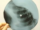 BOB DYLAN LAY LADY LAY X-Ray USSR Record Roentgen Bone Ribs Music Vinyl