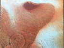 Pink Floyd Meddle 1st Press 1971 Uk Harvest Vinyl lp SHvl 795 + Inner 1U / 1U Ex