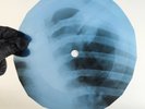 BEATLES YOU WONT SEE ME X-Ray USSR Record Roentgen Bone Ribs Music Vinyl