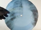 BLACK SABBATH WIZARD X-Ray USSR Record Roentgen Bone Ribs Music Vinyl