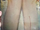 *NEW SEALED-LOS CAMPESINOS -Romance Is Boring, 2LP on Gold VINYL