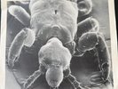THE ANAL FLEAS 
