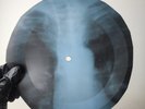 DAVID BOWIE ANDY WARHOL X-Ray USSR Record Roentgen Bone Ribs Music Vinyl
