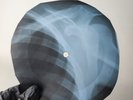 BEATLES SOMETHING X-Ray USSR Record Roentgen Bone Ribs Music Vinyl